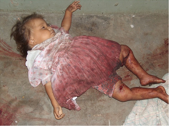 María Ángel, otra inocente de escasos 2 años de edad, víctima del terrorismo infame de las FARC. 